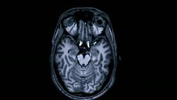 10 Things to Know About (Series 1): The Brain